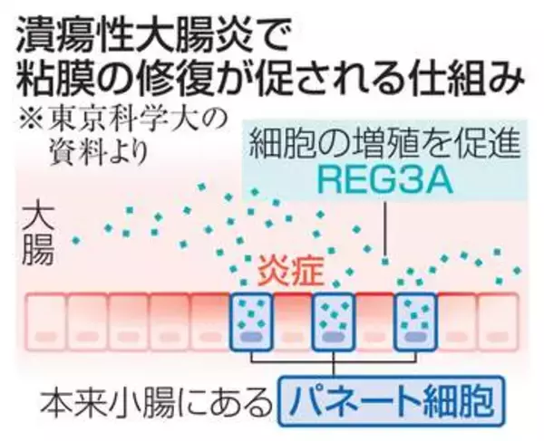 小腸細胞、大腸の粘膜を修復　慢性炎症で、治療法の改善に期待