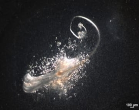 毛をつくる「第3の細胞」を発見　脱毛症治療に期待、マウスで実験