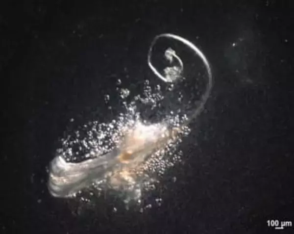 毛をつくる「第3の細胞」を発見　脱毛症治療に期待、マウスで実験