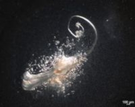 毛をつくる「第3の細胞」を発見　脱毛症治療に期待、マウスで実験