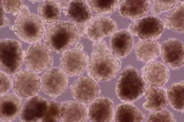 iPS細胞の心筋球、承認申請へ　移植治験で心機能改善を確認