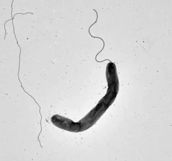 コレラ菌、光浴びて活発に　感染制御ヒントに、琉球大