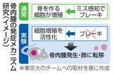「骨肉腫、増殖制御破綻が原因か　若者に発症、老化研究がヒント」の画像1