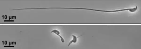 精子運動、特定タンパク質が必要　不妊治療に期待、大阪大