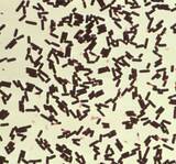 「放課後児童クラブで21人食中毒　津保健所、弁当屋を営業禁止処分」の画像1