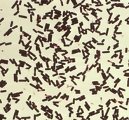放課後児童クラブで21人食中毒　津保健所、弁当屋を営業禁止処分