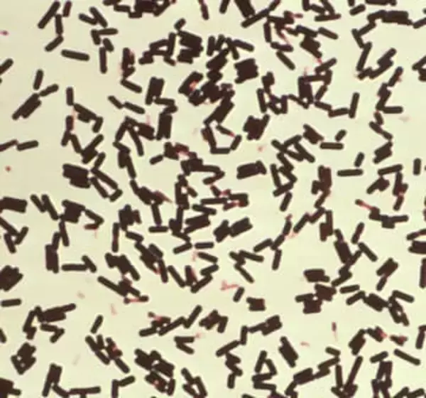 放課後児童クラブで21人食中毒　津保健所、弁当屋を営業禁止処分