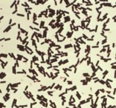 放課後児童クラブで21人食中毒　津保健所、弁当屋を営業禁止処分