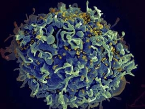 フィジーがHIV危機を宣言　南太平洋、薬物使用で感染急増
