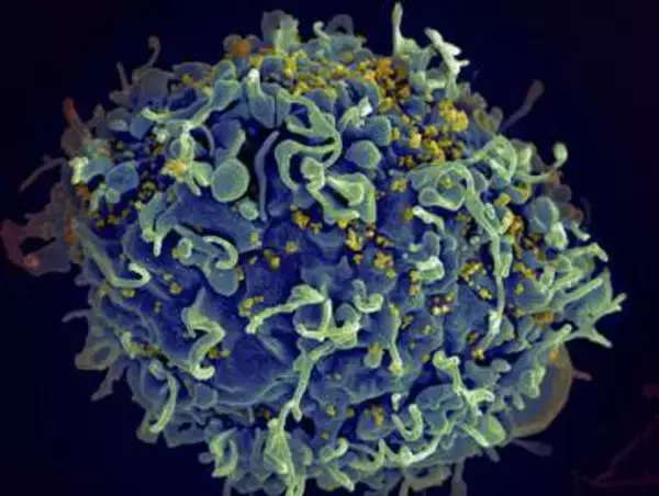 フィジーがHIV危機を宣言　南太平洋、薬物使用で感染急増