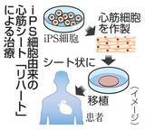 「iPS心筋シートに保険適用　2例目、心不全治療」の画像1