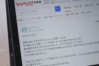 【独自】アデランス子会社がステマ　外部企業に報酬払って投稿を依頼