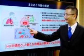 慢性炎症の原因物質特定　免疫細胞を制御、千葉大