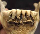 「中世の人骨歯石からキビ食確認　ウクライナで出土、奈文研」の画像1
