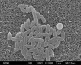 【独自】百日ぜき、薬剤耐性菌が8割　治療に弊害、感染症研究所調査