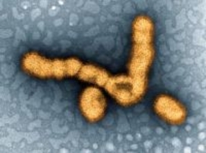 インフル流行、注意報レベルに　前週比2倍超、全国で増加