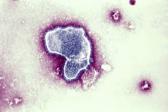 「抗体製剤」予防接種扱いに　ワクチン同様へ法改正検討