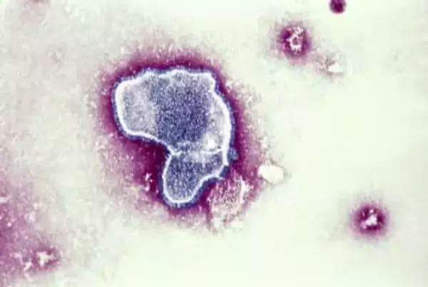 「抗体製剤」予防接種扱いに　ワクチン同様へ法改正検討