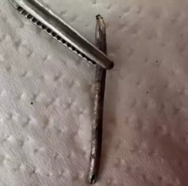 一般ごみにセシウム針混入か　大分・竹田、被ばく被害なし