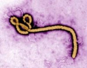 エボラ熱、死者100人超　コンゴ、医薬品不足訴え