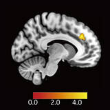 「ヒトが不公平な提案を受け入れる時の脳内メカニズムを解明」の画像1