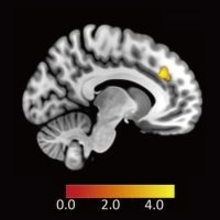 ヒトが不公平な提案を受け入れる時の脳内メカニズムを解明
