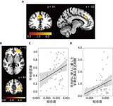 「ヒトが不公平な提案を受け入れる時の脳内メカニズムを解明」の画像4