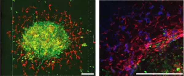 「卵巣癌の急速な腹膜播種形成のメカニズムを発見！」の画像