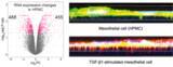 「卵巣癌の急速な腹膜播種形成のメカニズムを発見！」の画像5