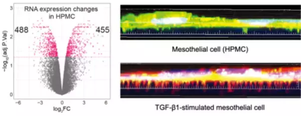 「卵巣癌の急速な腹膜播種形成のメカニズムを発見！」の画像