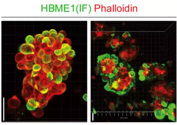 「卵巣癌の急速な腹膜播種形成のメカニズムを発見！」の画像
