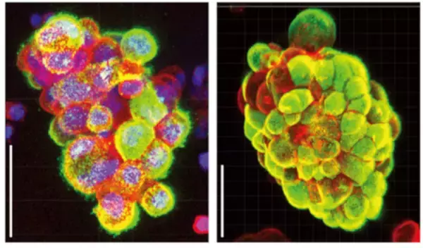 「卵巣癌の急速な腹膜播種形成のメカニズムを発見！」の画像