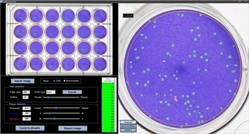 病原ウイルスの感染力を効率的に数値化できるソフトウェア「plaQuest」を開発