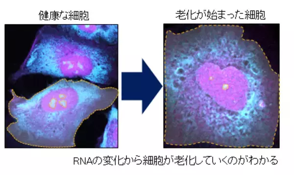 「無害な光を用いたイメージングによる細胞内DNA・RNAの同時検出」の画像