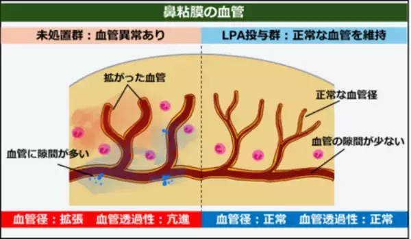 アレルギー性鼻炎を血管から治す 新しい仕組みによる治療法の可能性
