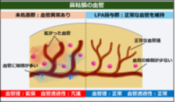 アレルギー性鼻炎を血管から治す 新しい仕組みによる治療法の可能性