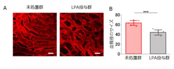 「アレルギー性鼻炎を血管から治す 新しい仕組みによる治療法の可能性」の画像