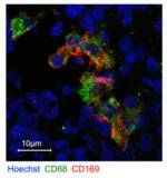 「妊娠に必須であるマクロファージを同定」の画像3