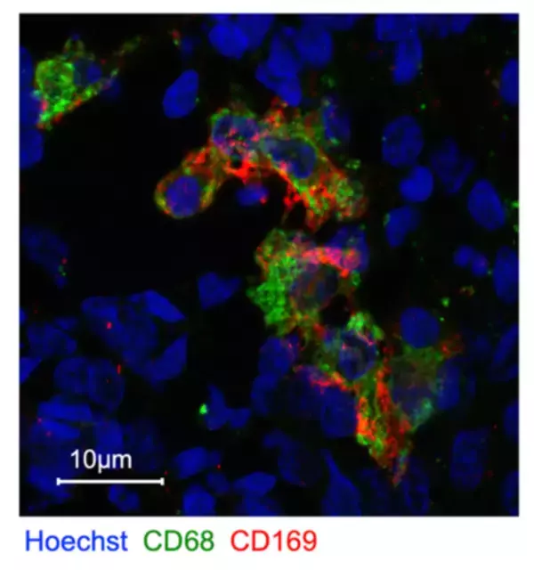 「妊娠に必須であるマクロファージを同定」の画像