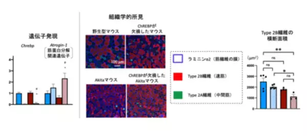 「ダイアベティス（糖尿病）に伴う筋肉の衰えを防ぐ仕組みを解明」の画像