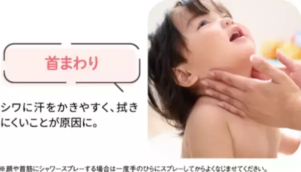 「あせも・肌あれを防ぐ低刺激ローション『水99％Super 薬用全身あせもシャワー』販売開始！」の画像
