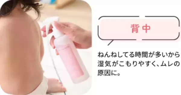 「あせも・肌あれを防ぐ低刺激ローション『水99％Super 薬用全身あせもシャワー』販売開始！」の画像