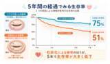 「日本人の僧帽弁輪石灰化に伴う僧帽弁狭窄症の長期予後を解明」の画像1