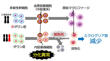 ダウン症胎児の脳免疫細胞の発生に異常がある可能性を初めて発見