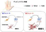 「糖尿病患者に多いデュピュイトラン拘縮の新たな線維化メカニズムを解明」の画像1