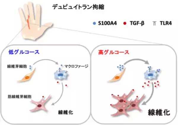 糖尿病患者に多いデュピュイトラン拘縮の新たな線維化メカニズムを解明