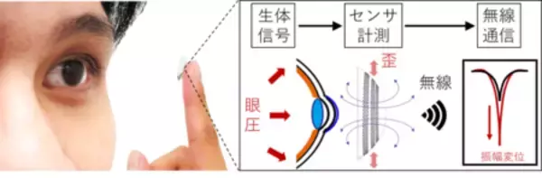 眼圧を高感度に無線計測するスマートコンタクトレンズを開発