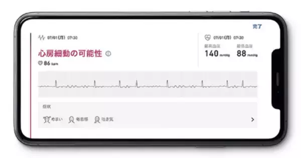 「メルカリスタジアムで行われる「Ｊリーグ×健康ハートの日2026」のイベントで血圧・心電図チェックを実施」の画像
