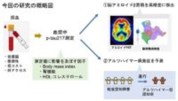 血液バイオマーカー“p-tau217”は脳内病理を高精度に検出し、アルツハイマー病の発症を予測する