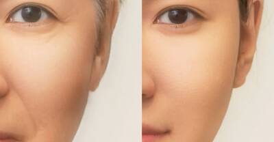 大正製薬が、細胞の若返りの鍵「マイトリガーゼ」の肌での役割を世界で初めて解明